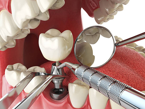 Best Knocked-Out Tooth Emergency  in New Union, TN